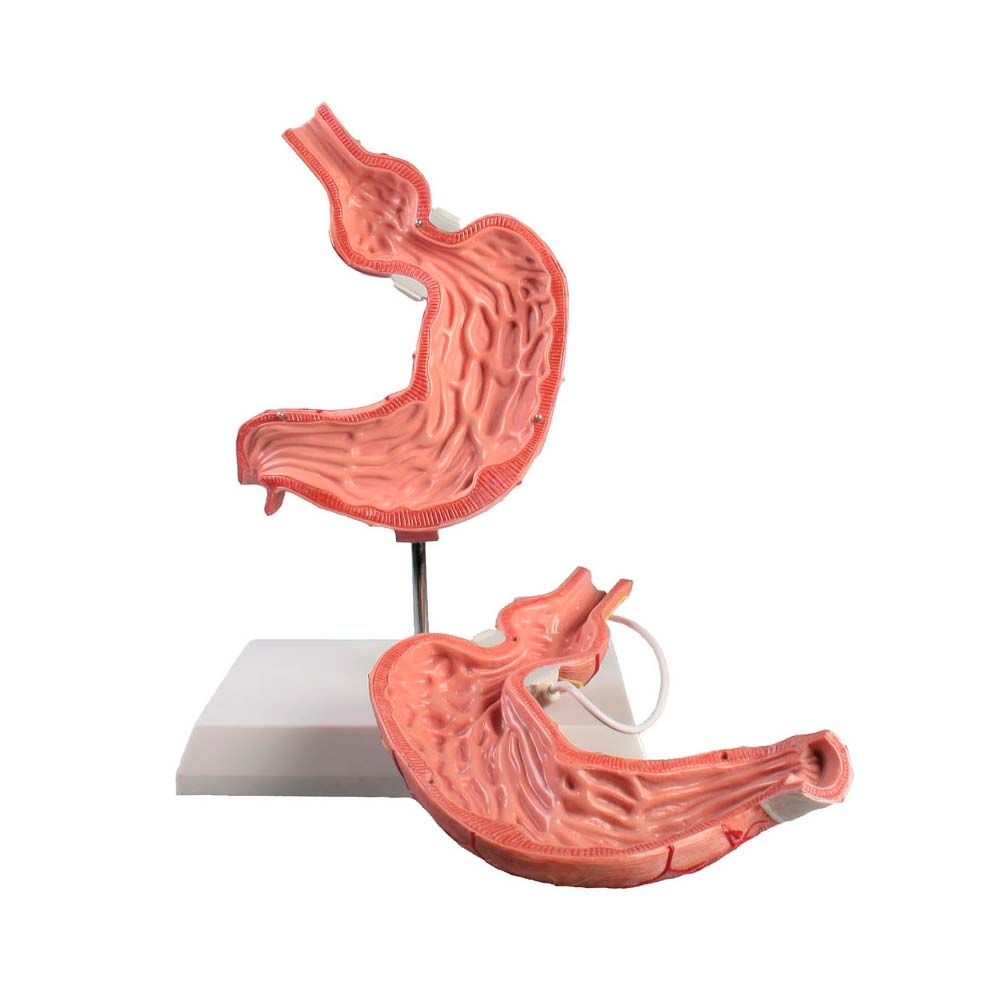 Magenmodell mit Magenband, mehrere Ansichtsteile am Stativständer